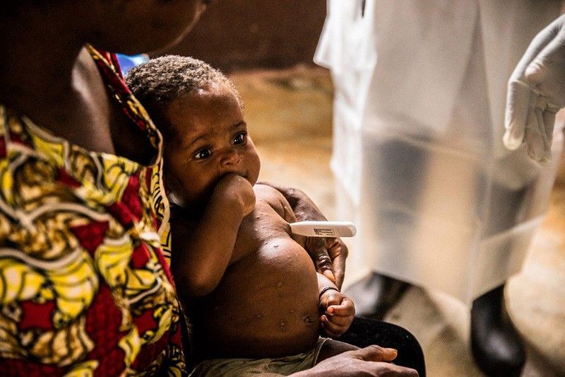 US preparing to deploy monkeypox vaccines amid more probable cases