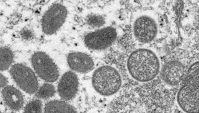 This undated electron microscopic (EM) handout image provided by the Centers for Disease Control and Prevention depicts a monkeypox virion, obtained from a clinical sample associated with the 2003 prairie dog outbreak. It was a thin section image from a human skin sample. On the left were mature, oval-shaped virus particles, and on the right were the crescents, and spherical particles of immature virions.