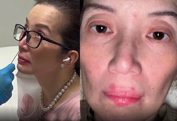 Kris Aquino shares health updates during Marcos inauguration: Getting COVID-19, chemotherapy