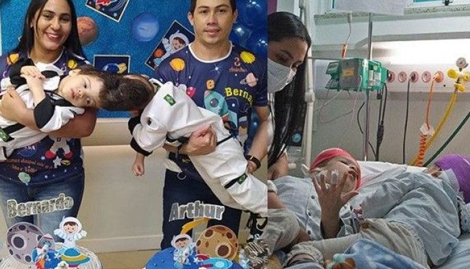 Conjoined twins separated with help of virtual reality in Brazil
