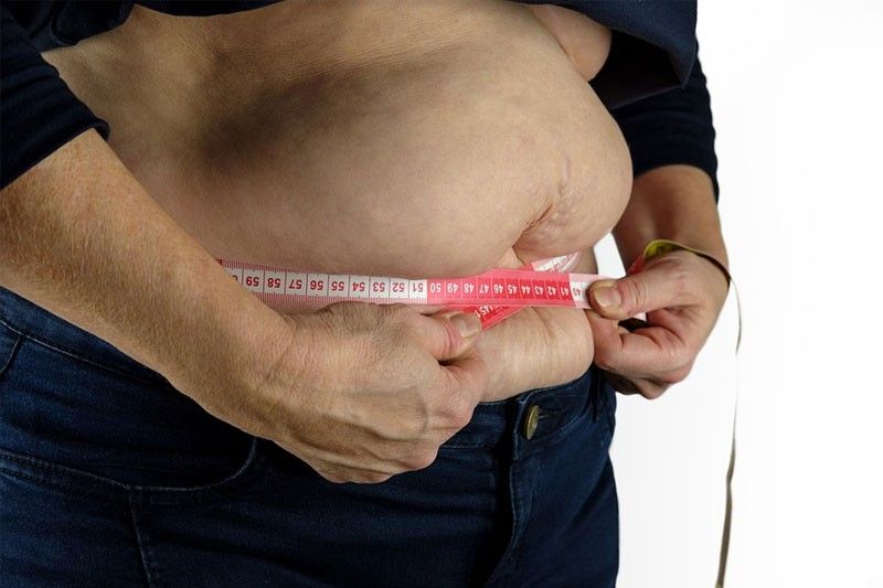 27 million Pinoys overweight or obese â�� global pharmaceutical firm