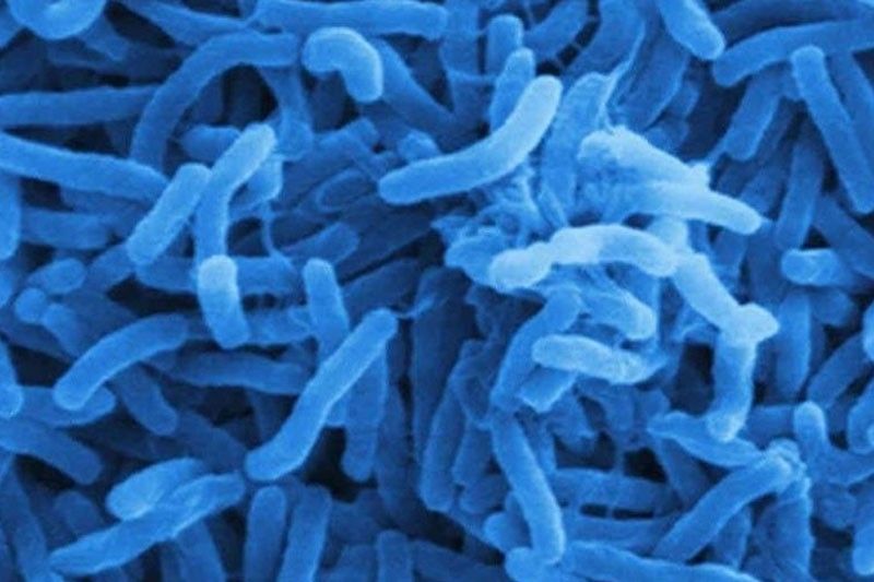 DOH: Cholera, not amoebiasis outbreak in San Carlos