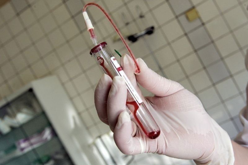 1,292 HIV cases naitala noong Pebrero - DOH