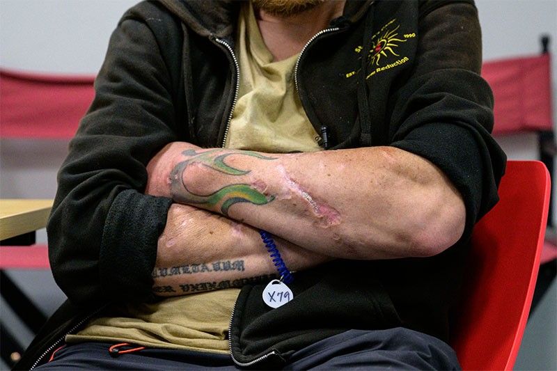 'Tranq': the flesh-rotting drug adding to America's opioid crisis