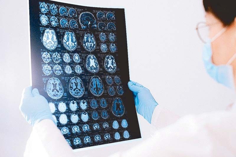Brain talk with top neurosurgeons