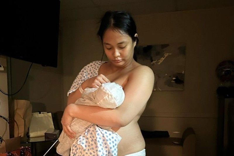 Lovely, nagka-postpartum depression pagkatapos ng operasyon