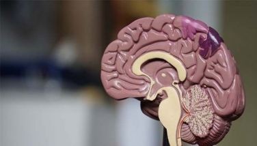 Up to 45% of dementia risk can be prevented, delayed: WHO