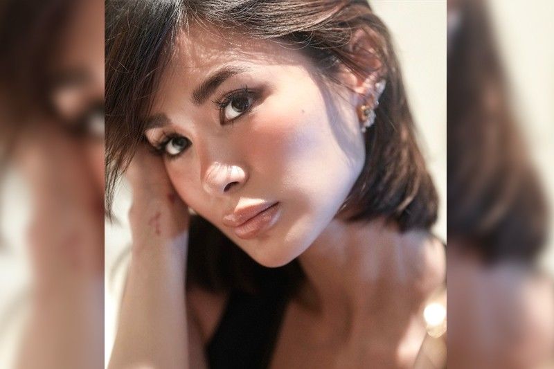 Heart Evangelista ‘na-trauma’ nang madisgrasya ipinaretokeng labi