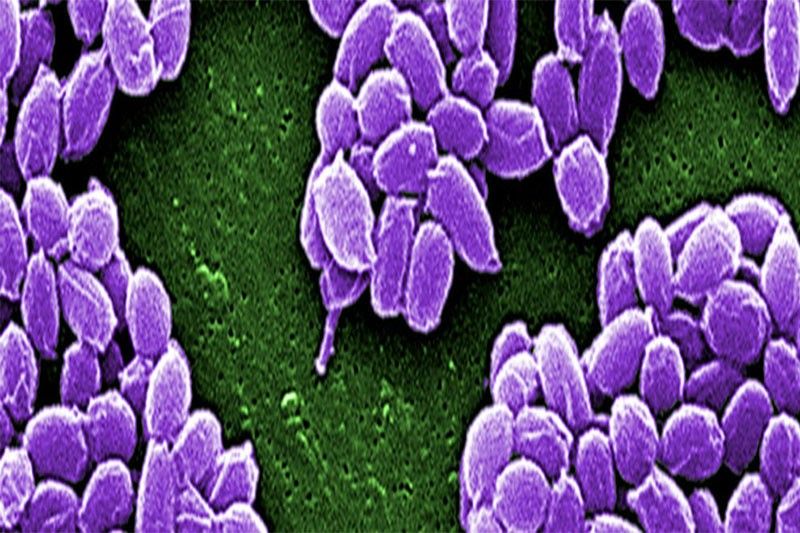 Thailand sounds alarm after anthrax outbreak in Laos
