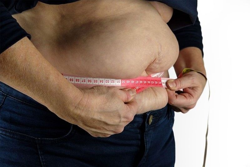 Living with obesity requires modifications, acceptance