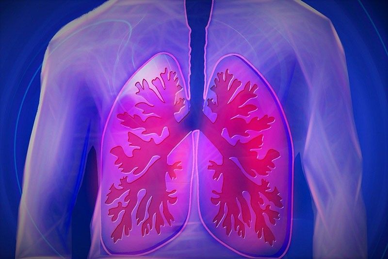 Interstitial Lung Disease: Alamin at labanan