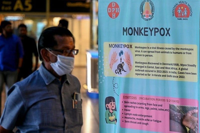 Businesses urged: Screen for mpox