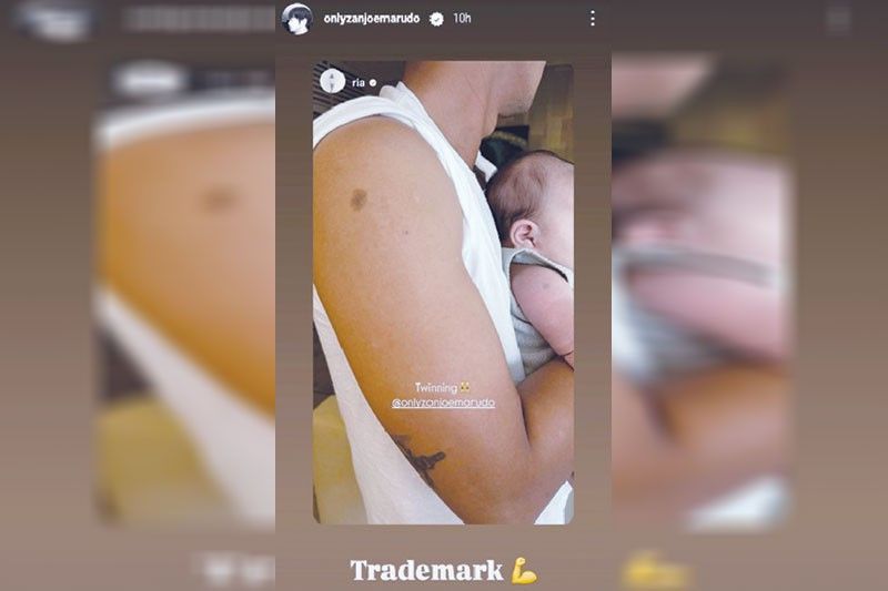 Zanjoe, twinning ang birthmark sa anak!