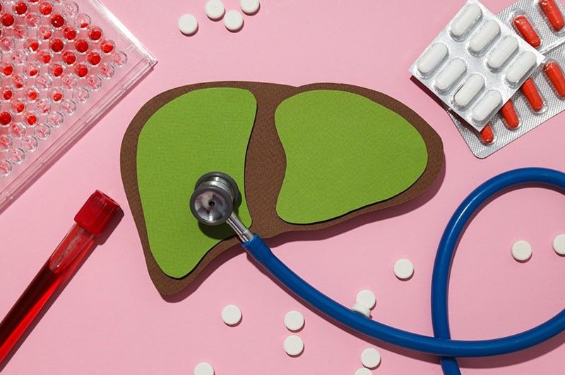 Don't let liver disease sneak up on you: The right supplement can make a difference