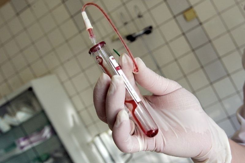 Socmed post sa âHIV-infectedâ needles sa blood tests, peke â DOH