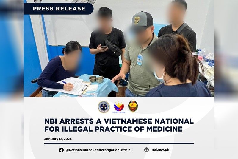 Vietnamese national nagpanggap na cosmetic surgeon, timbog sa NBI