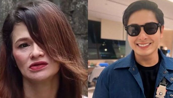 Katherine Luna thanks ex Coco Martin, Julia Montes for her eye surgery