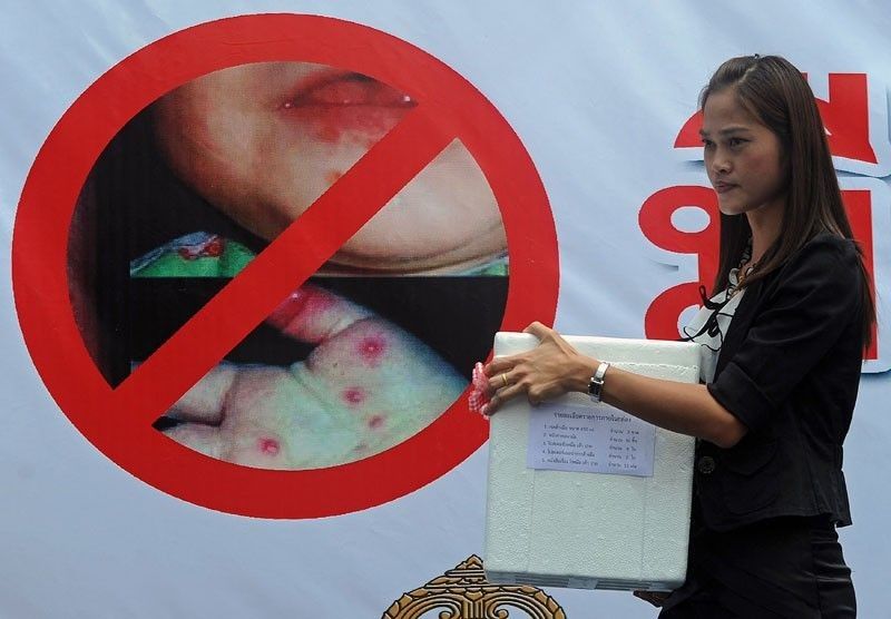 Bulacan logs 1,000% increase in HFMD cases
