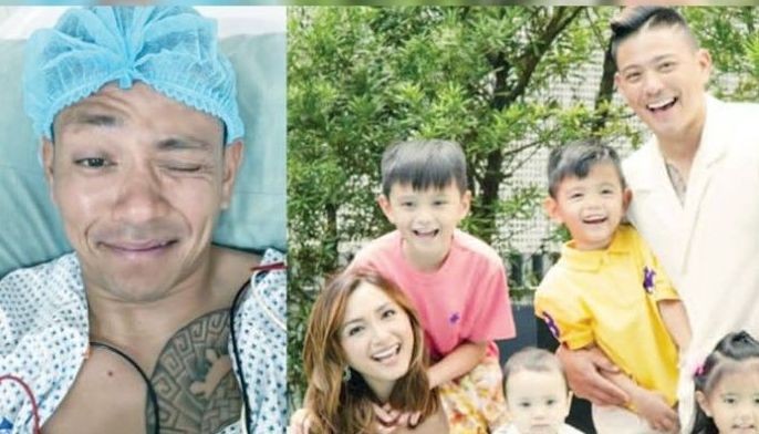 Commission on Population and Development commends Drew Arellano for undergoing vasectomy