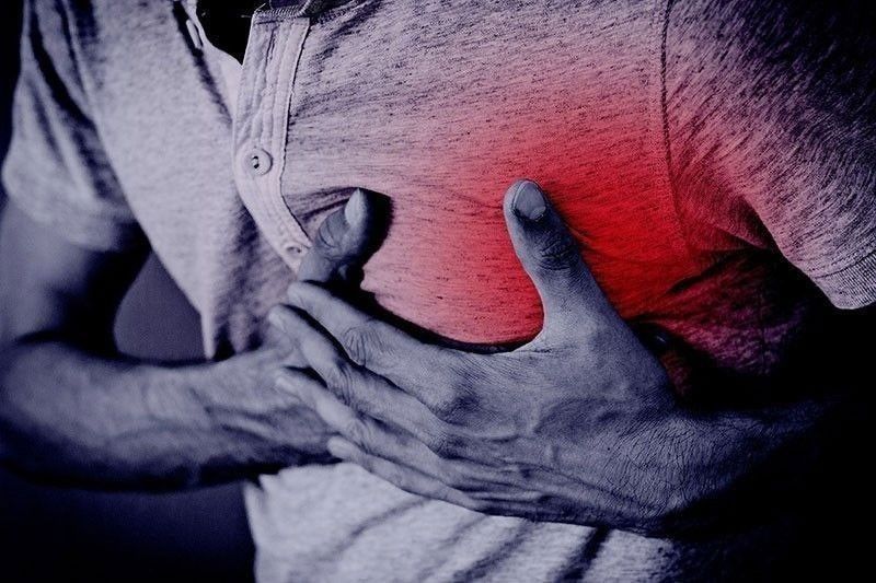 ‘Bangungot,’ dulot ng heart disorder