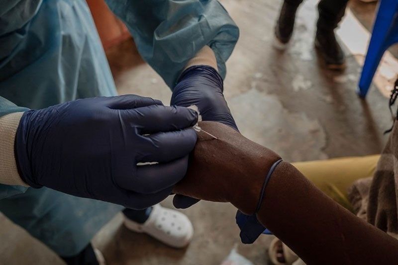 6 mpox cases reported in Davao City