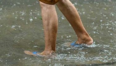 Protect your kidneys: Doctor shares how to avoid Leptospirosis