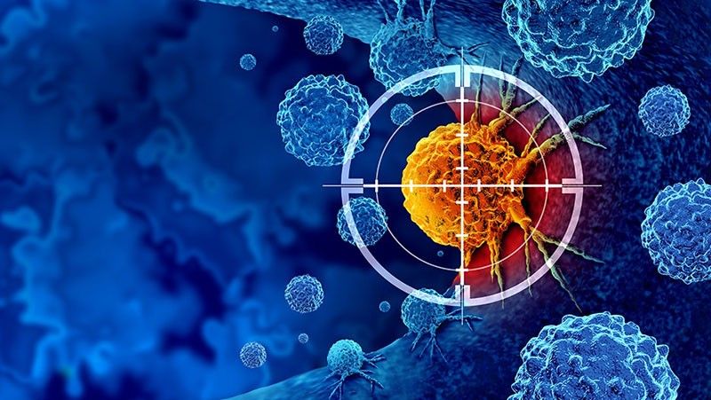 What Filipinos need to know about head and neck cancer