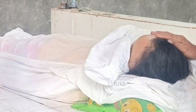 Woman allergic to insect bites dies from bee sting