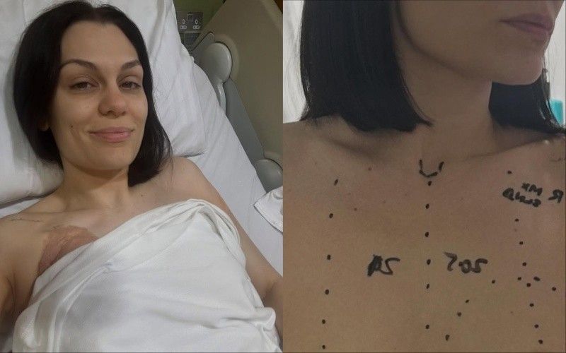 Jessie J undergoes breast cancer surgery