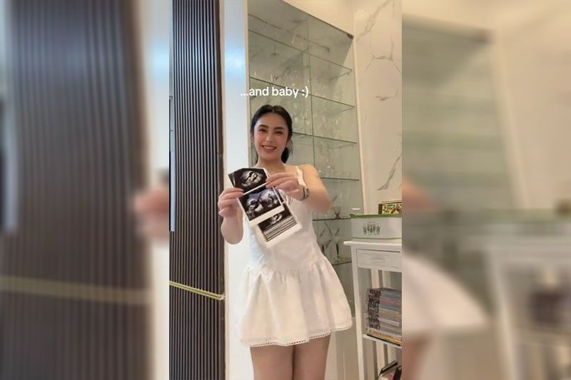 Bea, nilantad ang pagbubuntis