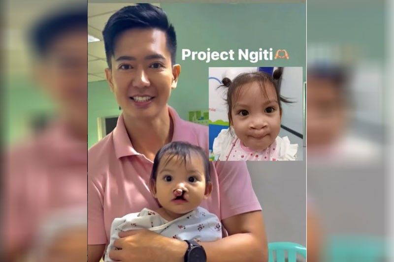 Ronnie, nanlibre ng operasyon!