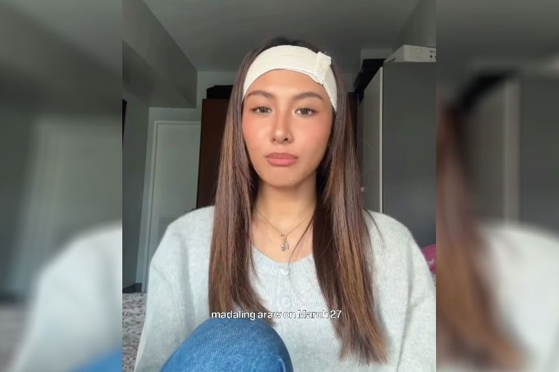 Thea, nabagokang ulo!