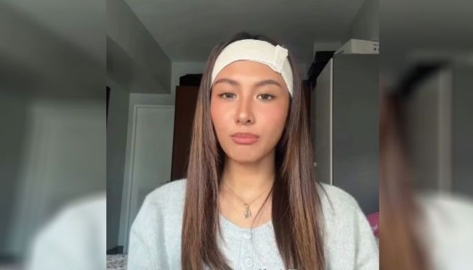 Thea, nabagokang ulo!