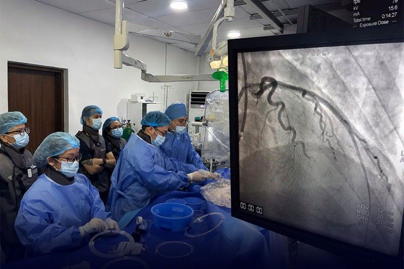 3rd angioplasty procedure sa Ospital ng Maynila, tagumpay