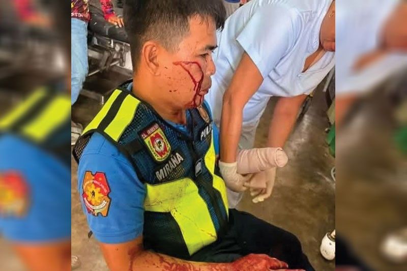 Parak tinagpas kamay ng nag-amok na baliw!
