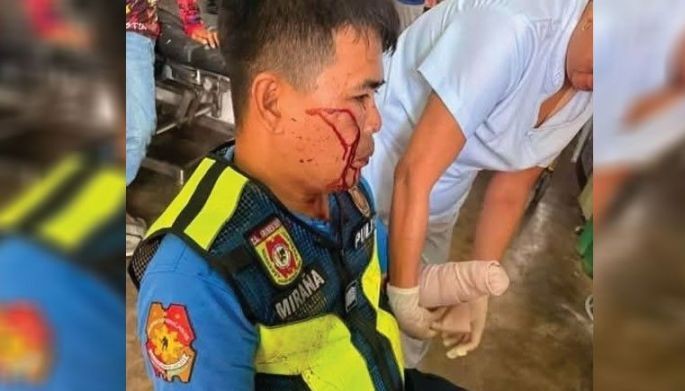 Parak tinagpas kamay ng nag-amok na baliw!