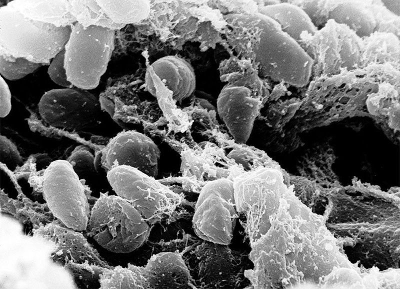 Pagkalat ng ‘pneumonic plague’ sa Pinas, may ‘zero possibility’
