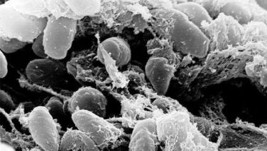 Pagkalat ng ‘pneumonic plague’ sa Pinas, may ‘zero possibility’