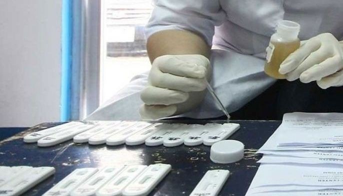 LTO magkakasa ng random drug test sa mga bus driver sa Undas